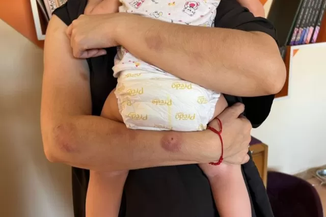 Azərbaycanda müəllim əri tərəfindən zorakılığa məruz qalıb