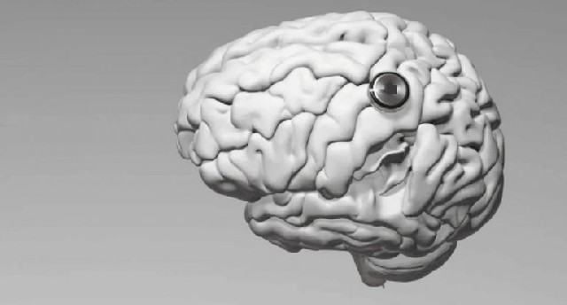 Çin insan beyninə implant yerləşdirdi: Artıq düşüncə ilə videooyun oynayır