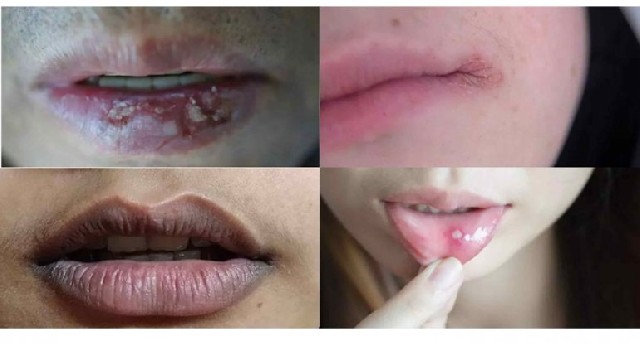 UÃ§uq kimi gÃ¶rÃ¼nsÉ dÉ, ciddi xÉstÉliklÉrin ÉlamÉti ola bilÉr