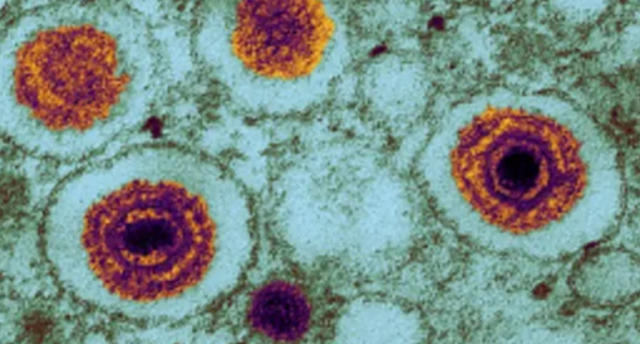 Alimlər yeni təhlükəli virus aşkarlayıblar